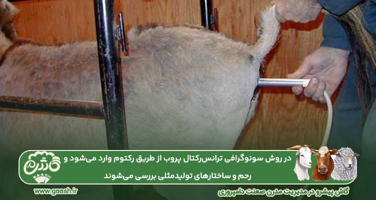 سونوگرافی ترانس&zwnj; رکتال
